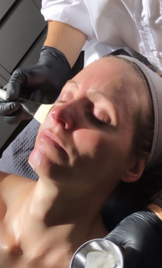 Eine Frau erhält eine professionelle Gesichtsbehandlung bei Skinthusiast in Hamburg Bergedorf. Ein Hautpflegeexperte trägt mit einem Pinsel eine Behandlung auf ihr Gesicht auf.