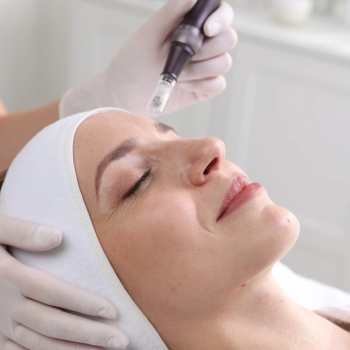 Gesichtsbehandlung Microneedling